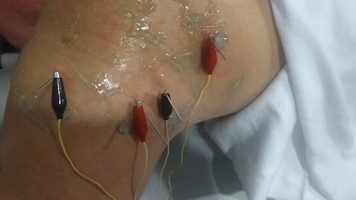 Amr Fisioterapia Avanzada